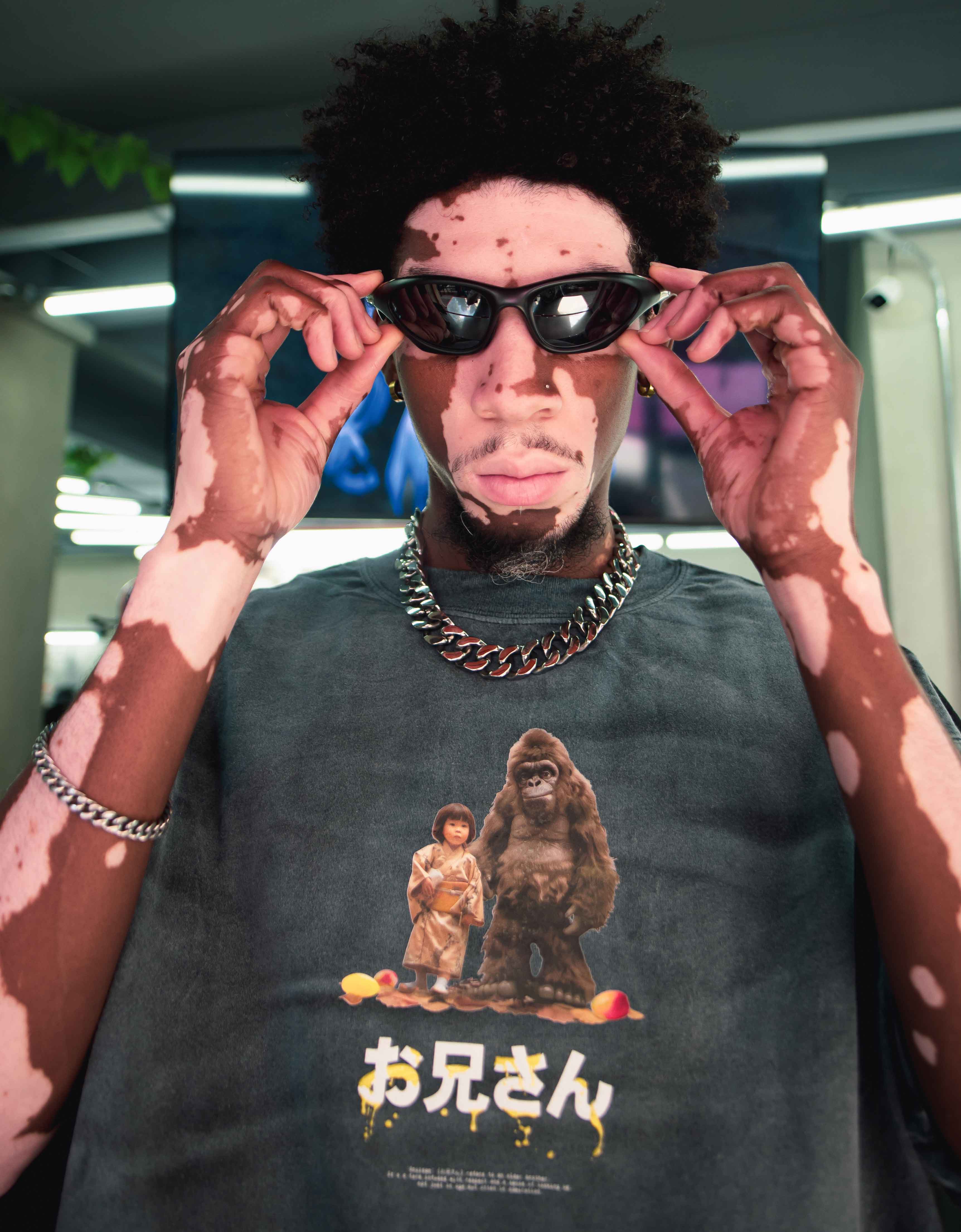 A person with vitiligo adjusts black sunglasses while wearing Machina's "Big Brother" t-shirt, which features a child and a gorilla alongside Japanese text to evoke a mystical connection. They accessorize with a chain necklace and a silver bracelet, set against a blurred background that highlights their expressive look.