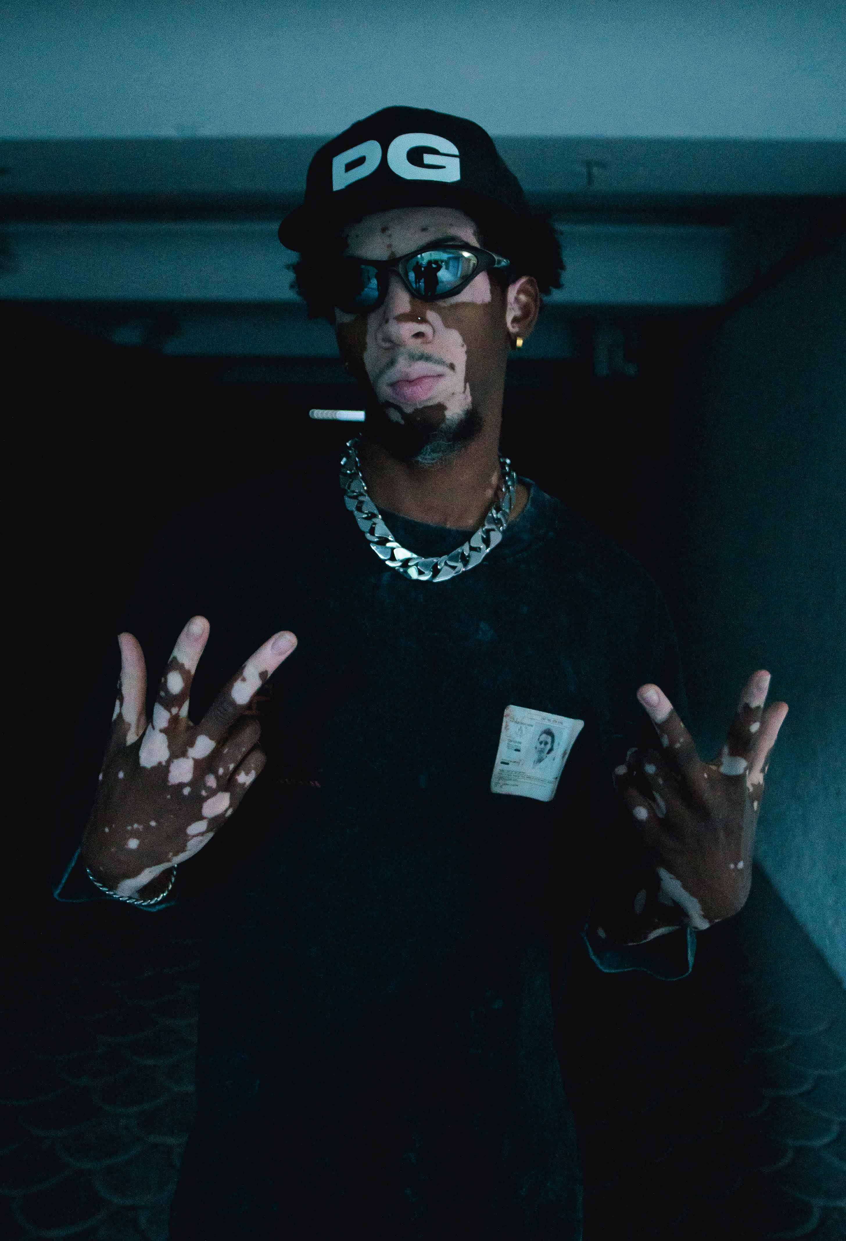 A person with a unique skin condition is posing while wearing Machina's wearable technology—a black cap featuring the DG logo, sunglasses, a chain necklace, and a dark T-shirt. They're flashing peace signs with both hands against a dimly lit backdrop that evokes an air of mystery reminiscent of "Pioneers in Genetic Research" tales about Bigfoot cloning.